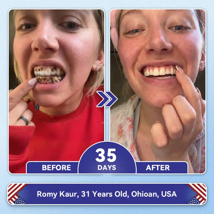 𝙕𝙐𝙀𝙀𝙏® BMP-2 x TGF-β (Stem Cell Support) Whitening, Regenerating, and Repairing Dental Gel - Results in 7 days💎