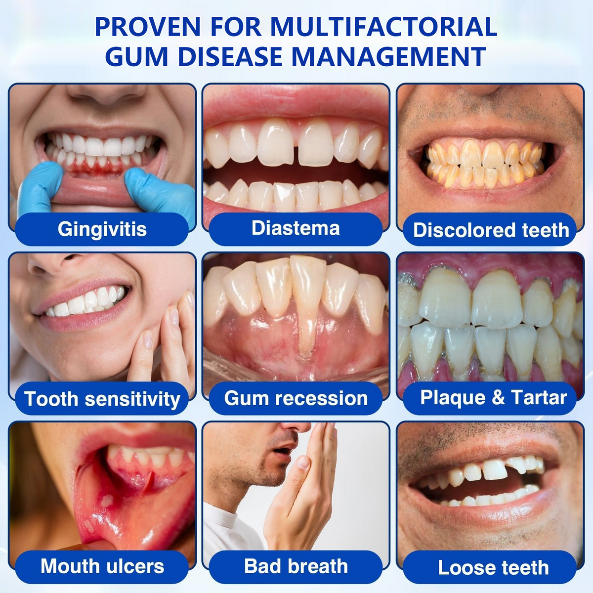 🏅🦷🛡️BUY 4 GET 4 FREE LOVILDS® GumRevive Advanced Gum Care & Repair Gel🌞