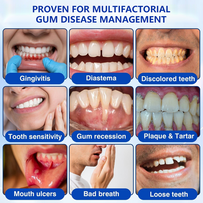 🏅🦷🛡️BUY 4 GET 4 FREE LOVILDS® GumRevive Advanced Gum Care & Repair Gel🌞
