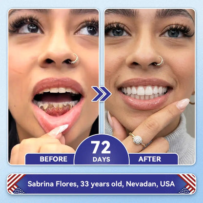 𝙕𝙐𝙀𝙀𝙏® BMP-2 x TGF-β (Stem Cell Support) Whitening, Regenerating, and Repairing Dental Gel - Results in 7 days💎