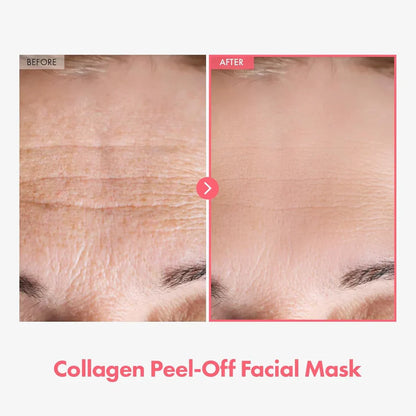 💥Limited Time Sales - 50% OFF💥Arbutin 7% + Tranexamic Acid 4% Cream