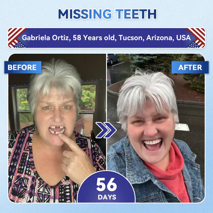 𝙕𝙐𝙀𝙀𝙏® BMP-2 x TGF-β (Stem Cell Support) Whitening, Regenerating, and Repairing Dental Gel - Results in 7 days💎