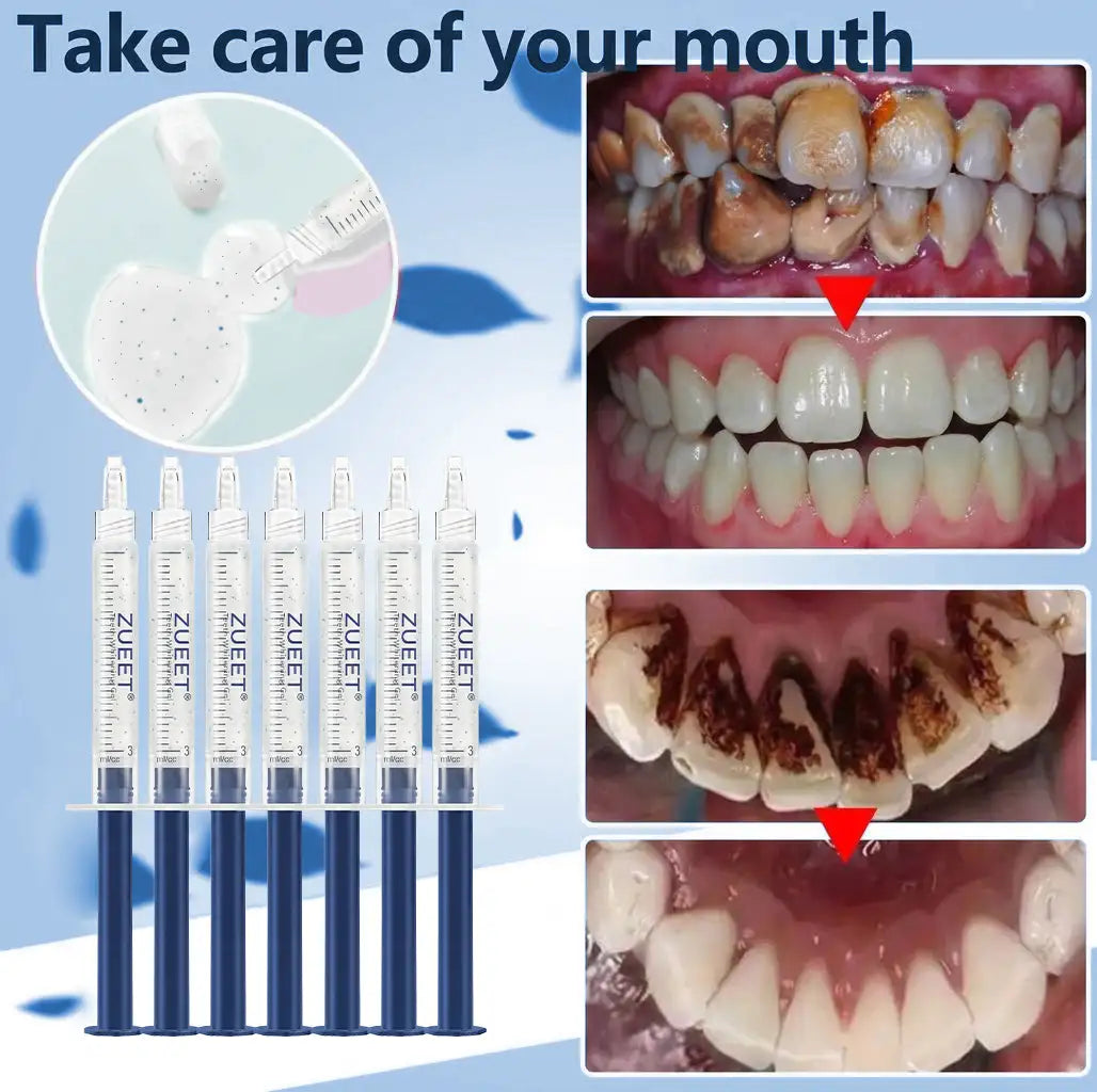 𝙕𝙐𝙀𝙀𝙏® BMP-2 x TGF-β (Stem Cell Support) Whitening, Regenerating, and Repairing Dental Gel - Results in 7 days💎