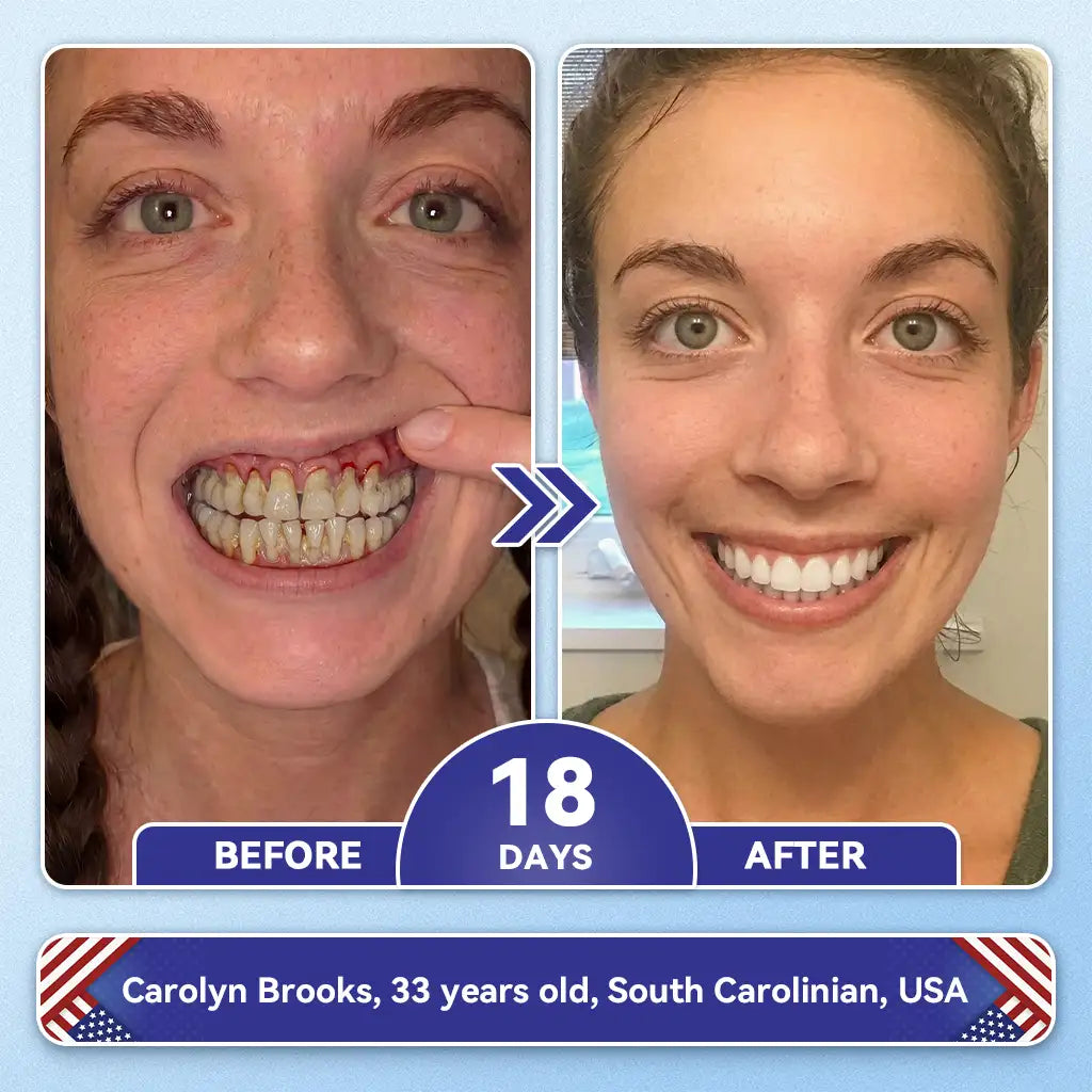 𝙕𝙐𝙀𝙀𝙏® BMP-2 x TGF-β (Stem Cell Support) Whitening, Regenerating, and Repairing Dental Gel - Results in 7 days💎