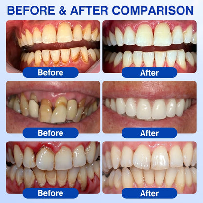 🏅🦷🛡️BUY 4 GET 4 FREE LOVILDS® GumRevive Advanced Gum Care & Repair Gel🌞