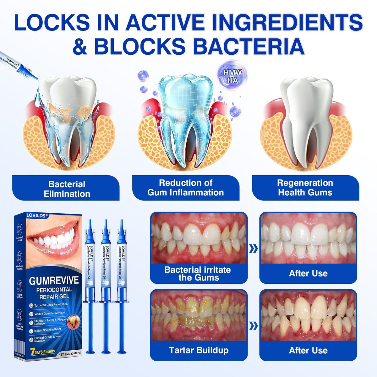 🏅🦷🛡️BUY 4 GET 4 FREE LOVILDS® GumRevive Advanced Gum Care & Repair Gel🌞