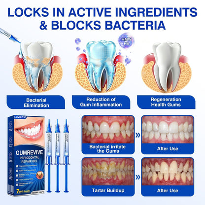 🏅🦷🛡️BUY 4 GET 4 FREE LOVILDS® GumRevive Advanced Gum Care & Repair Gel🌞