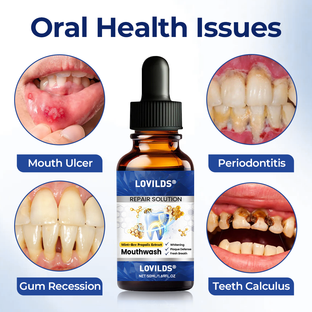Buy 3 get 3 free🏅🦷🛡️ LOVILDS Bee Propolis Extract Oral Repair Solution