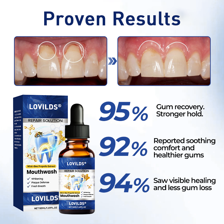 Buy 3 get 3 free🏅🦷🛡️ LOVILDS Bee Propolis Extract Oral Repair Solution