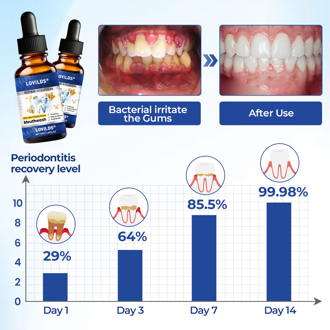 Buy 3 get 3 free🏅🦷🛡️ LOVILDS Bee Propolis Extract Oral Repair Solution