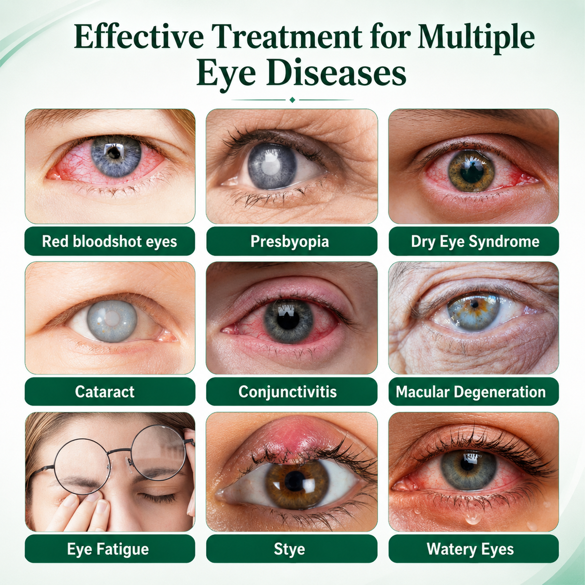 Buy 4 Get 3 Free TAILEDEN® Lutein Eye Care Spray — ✨✨Say Goodbye to Blurry Eyes! Lutein Delivered Right To Your Eyes✨👁️👁️✨