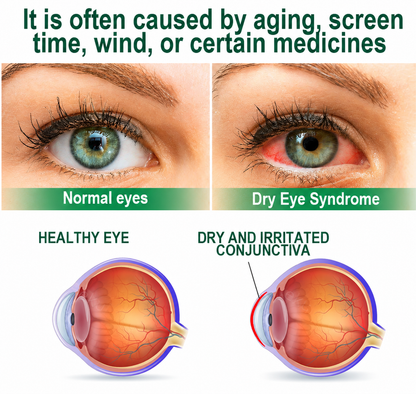 Buy 4 Get 3 Free TAILEDEN® Lutein Eye Care Spray — ✨✨Say Goodbye to Blurry Eyes! Lutein Delivered Right To Your Eyes✨👁️👁️✨