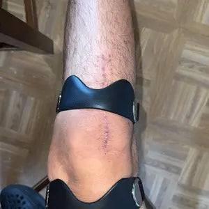 🔥 Most popular  🔥Targeted Patellar Support for Pain-Free Movement