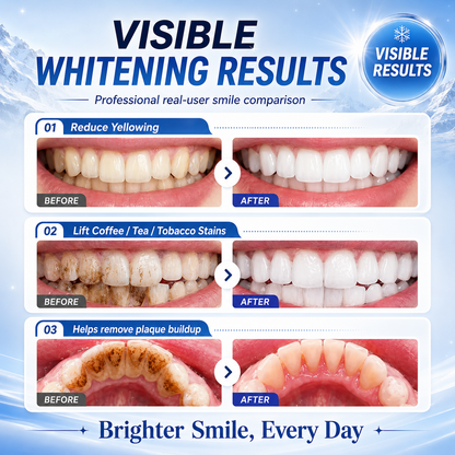 🔥 🔥50% OFF Niacinamide Foaming Whitening Toothpaste 8X - Fresh Breath Stain Removal Gentle Teeth Cleaning 🔥🔥