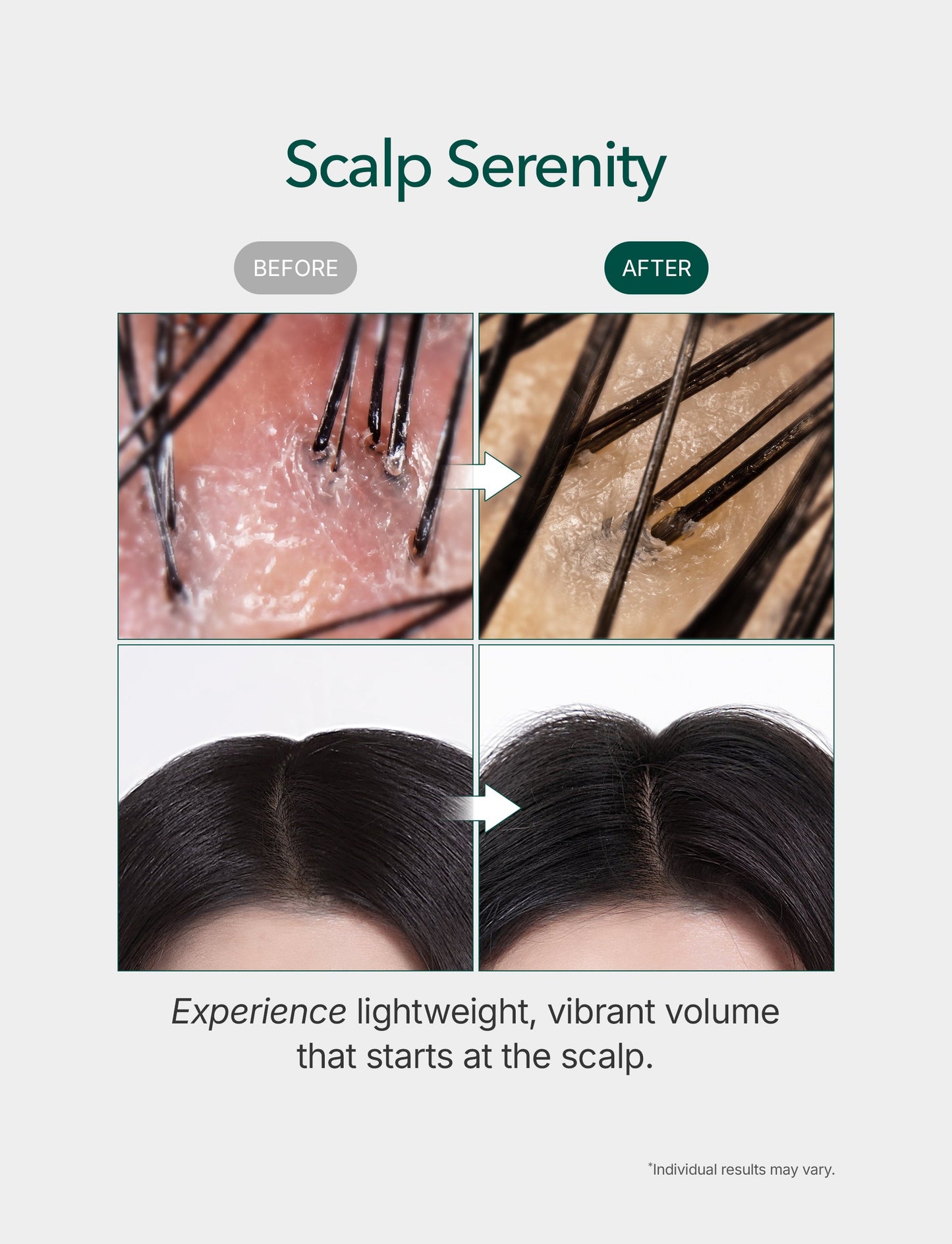 Rosemary & Multi-Peptide Hair Growth Serum