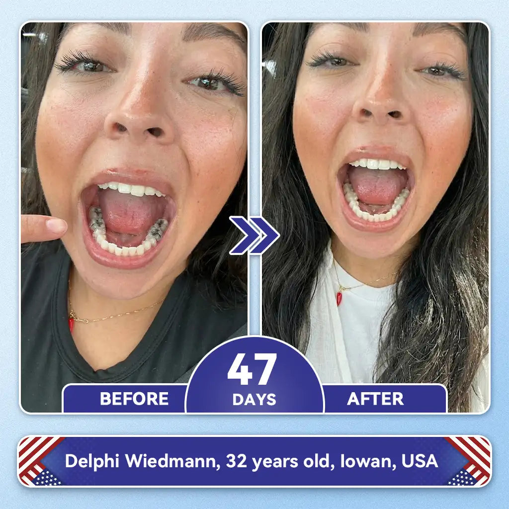 𝙕𝙐𝙀𝙀𝙏® BMP-2 x TGF-β (Stem Cell Support) Whitening, Regenerating, and Repairing Dental Gel - Results in 7 days💎