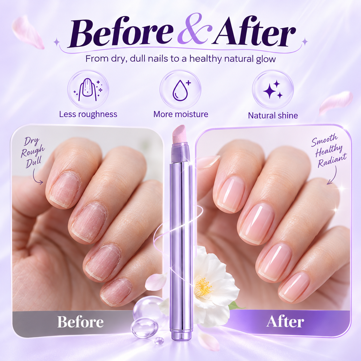 💟Buy 3 Get 3Free 💅3-in-1 Nail Care Serum Oil Pen – Cuticle Remover, Nail Polish Remover & Nail Oil Treatment