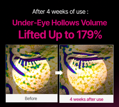 🔥LAST DAY 50% OFF!! NatureEss Korean Calcium Dark Spot Eye Cream