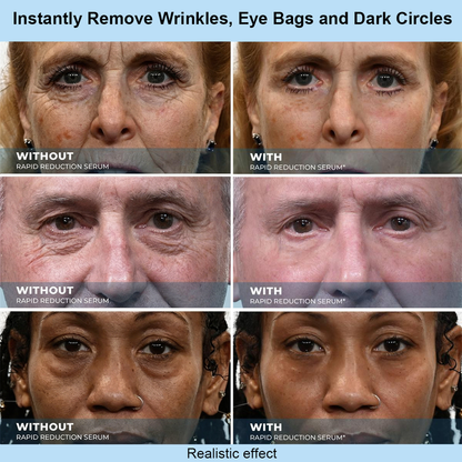 Natvely Instant Face Temporary Tightener – Instant visible results in 30 seconds