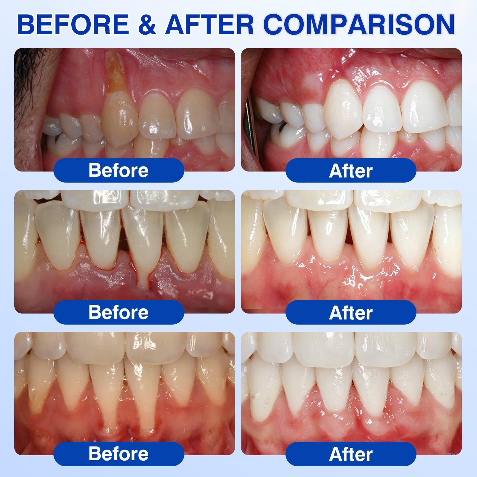 Before and after comparison