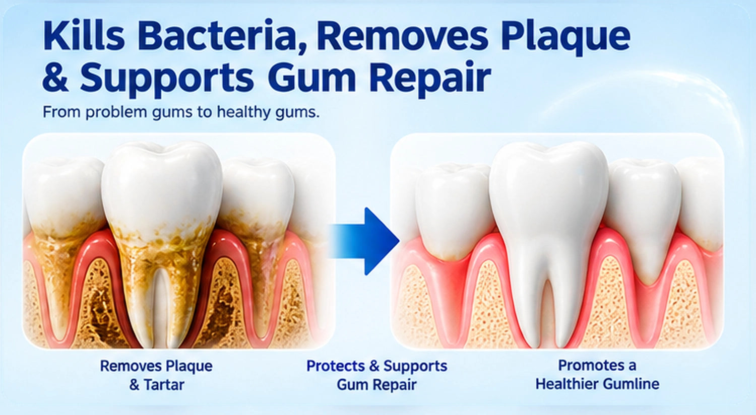 Removes plaque and supports gum repair